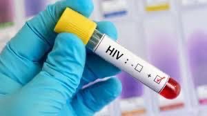 HIV: Maranhão soma mais de 9 mil novos casos em três anos
